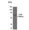 CD58 Molecule antibody, NBP2-12172, Novus Biologicals, Western Blot image 