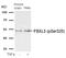 F-Box And Leucine Rich Repeat Protein 3 antibody, GTX55303, GeneTex, Western Blot image 