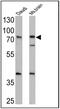 Amiloride-sensitive sodium channel subunit alpha antibody, PA1-920A, Invitrogen Antibodies, Western Blot image 