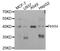 RD antibody, STJ28226, St John