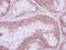 Plasminogen Activator, Urokinase antibody, GTX111747, GeneTex, Immunohistochemistry paraffin image 