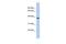 Fat Storage Inducing Transmembrane Protein 1 antibody, PA5-44060, Invitrogen Antibodies, Western Blot image 