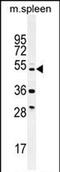 Tetratricopeptide Repeat Domain 23 Like antibody, PA5-71558, Invitrogen Antibodies, Western Blot image 
