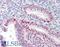 Ribosomal Oxygenase 1 antibody, 46-636, ProSci, Western Blot image 