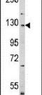 Dishevelled Associated Activator Of Morphogenesis 2 antibody, PA5-14550, Invitrogen Antibodies, Western Blot image 