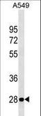 VAMP Associated Protein B And C antibody, LS-C157340, Lifespan Biosciences, Western Blot image 