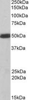 C-Terminal Src Kinase antibody, EB05118, Everest Biotech, Western Blot image 