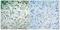 RB Transcriptional Corepressor 1 antibody, GTX50193, GeneTex, Immunohistochemistry paraffin image 