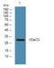 Voltage Dependent Anion Channel 3 antibody, A04802-1, Boster Biological Technology, Western Blot image 