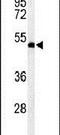 RuvB Like AAA ATPase 1 antibody, PA5-24579, Invitrogen Antibodies, Western Blot image 