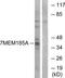 Transmembrane Protein 185A antibody, TA315923, Origene, Western Blot image 