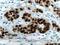 Progesterone Receptor antibody, 66300-1-Ig, Proteintech Group, Immunohistochemistry paraffin image 