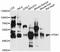 Pyruvate Dehydrogenase Kinase 1 antibody, STJ24945, St John