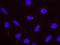 Protein Phosphatase 1 Catalytic Subunit Gamma antibody, NB110-40551, Novus Biologicals, Proximity Ligation Assay image 