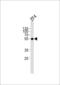 Ankyrin Repeat Domain 13C antibody, LS-C344705, Lifespan Biosciences, Western Blot image 