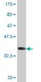 Nuclear Receptor Binding SET Domain Protein 1 antibody, H00064324-M06, Novus Biologicals, Western Blot image 