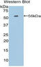 Proopiomelanocortin antibody, LS-C296064, Lifespan Biosciences, Western Blot image 