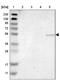 Serum/Glucocorticoid Regulated Kinase 2 antibody, NBP1-86102, Novus Biologicals, Western Blot image 