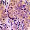 Activating Transcription Factor 2 antibody, orb216067, Biorbyt, Immunohistochemistry paraffin image 