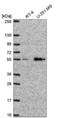 Solute Carrier Family 29 Member 4 antibody, NBP2-55497, Novus Biologicals, Western Blot image 