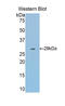 Fascin Actin-Bundling Protein 1 antibody, LS-C297158, Lifespan Biosciences, Western Blot image 