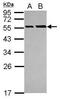 Egl-9 Family Hypoxia Inducible Factor 3 antibody, PA5-29260, Invitrogen Antibodies, Western Blot image 