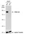 Protein Kinase C Substrate 80K-H antibody, NBP2-19931, Novus Biologicals, Western Blot image 