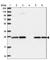 NAD(P)HX Epimerase antibody, HPA043766, Atlas Antibodies, Western Blot image 