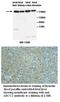 ATP Binding Cassette Subfamily C Member 2 antibody, MBS416391, MyBioSource, Western Blot image 