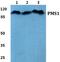 PMS1 Homolog 1, Mismatch Repair System Component antibody, A04425, Boster Biological Technology, Western Blot image 