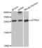 Cyclin Dependent Kinase Inhibitor 1B antibody, abx000672, Abbexa, Western Blot image 