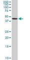 ADP Dependent Glucokinase antibody, H00083440-M01, Novus Biologicals, Western Blot image 