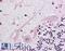 Sodium Voltage-Gated Channel Alpha Subunit 3 antibody, LS-A8070, Lifespan Biosciences, Immunohistochemistry frozen image 