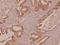 Galectin 7B antibody, A12693-1, Boster Biological Technology, Immunohistochemistry paraffin image 