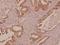 Galectin 7B antibody, A12693-1, Boster Biological Technology, Immunohistochemistry paraffin image 