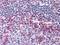 CD69 Molecule antibody, NBP1-51607, Novus Biologicals, Immunohistochemistry paraffin image 