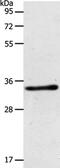 Aspartoacylase-2 antibody, PA5-50302, Invitrogen Antibodies, Western Blot image 