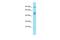 Family With Sequence Similarity 171 Member A2 antibody, A16835, Boster Biological Technology, Western Blot image 