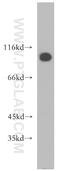ATPase Secretory Pathway Ca2+ Transporting 1 antibody, 13310-1-AP, Proteintech Group, Western Blot image 