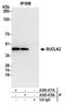 Succinate-CoA Ligase ADP-Forming Beta Subunit antibody, A305-478A, Bethyl Labs, Immunoprecipitation image 
