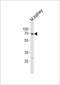 Bone Morphogenetic Protein Receptor Type 1A antibody, LS-C97653, Lifespan Biosciences, Western Blot image 