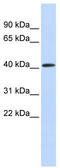 Poly(ADP-Ribose) Polymerase Family Member 11 antibody, TA334266, Origene, Western Blot image 