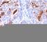 Carcinoembryonic Antigen Related Cell Adhesion Molecule 5 antibody, V2090IHC-7ML, NSJ Bioreagents, Immunohistochemistry paraffin image 