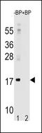 Microtubule Associated Protein 1 Light Chain 3 Alpha antibody, LS-C165699, Lifespan Biosciences, Western Blot image 