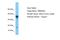 Transmembrane Protein 220 antibody, A18655, Boster Biological Technology, Western Blot image 