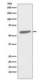 Keratin 5 antibody, M00398-1, Boster Biological Technology, Western Blot image 
