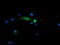 Snail Family Transcriptional Repressor 2 antibody, LS-C174043, Lifespan Biosciences, Immunofluorescence image 