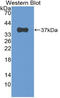 Eukaryotic Translation Initiation Factor 2 Alpha Kinase 2 antibody, LS-C314531, Lifespan Biosciences, Western Blot image 