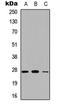 Complement Factor D antibody, LS-C354273, Lifespan Biosciences, Western Blot image 