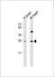 Dickkopf WNT Signaling Pathway Inhibitor 2 antibody, M06431, Boster Biological Technology, Western Blot image 
